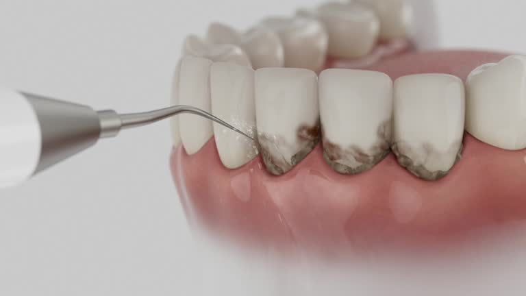 Reliable Dental Implants contractor in Fritch, TX by Smile Center Dentistry